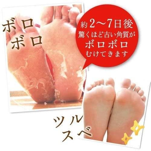 Liberta Baby Foot Exfoliation Foot Peel 30 Minutes Treatment - Size S - Image 4